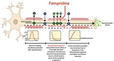 Clinical, Neurophysiological, and MRI Markers of Fampridine Responsiveness in Multiple Sclerosis—An Explorative Study